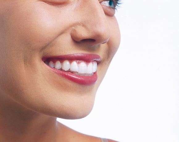 Invisalign Horsford